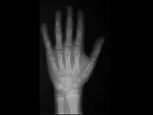 Radiografía de una mano en la clínica del endocrino Marcos Sopena